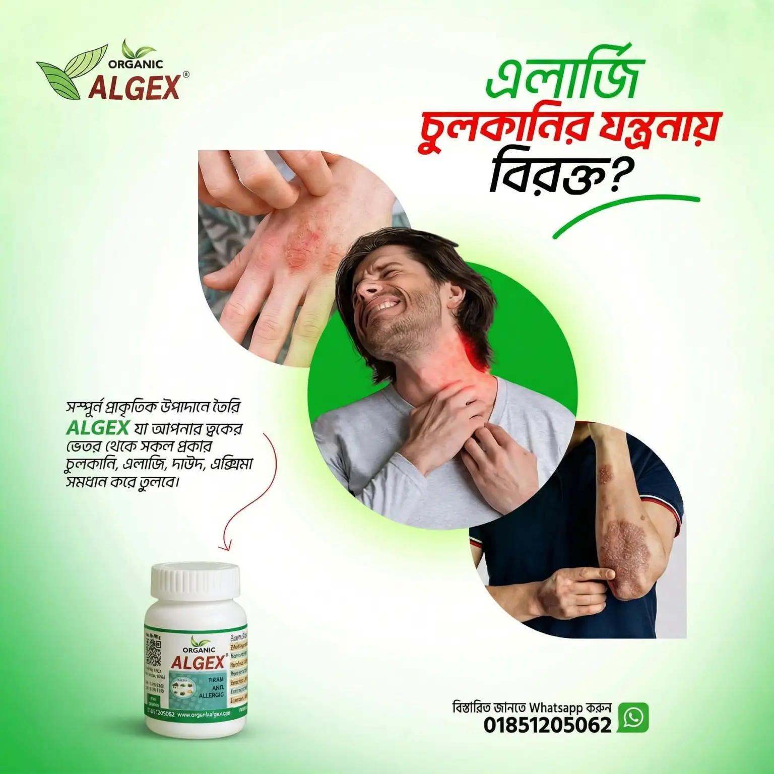 দাউদ ও চুলকানি থেকে মুক্তি